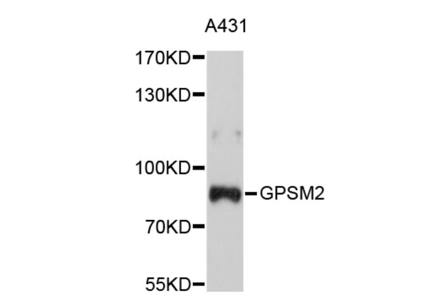 Western Blot - Anti-GPSM2 Antibody (A4677) - Antibodies.com