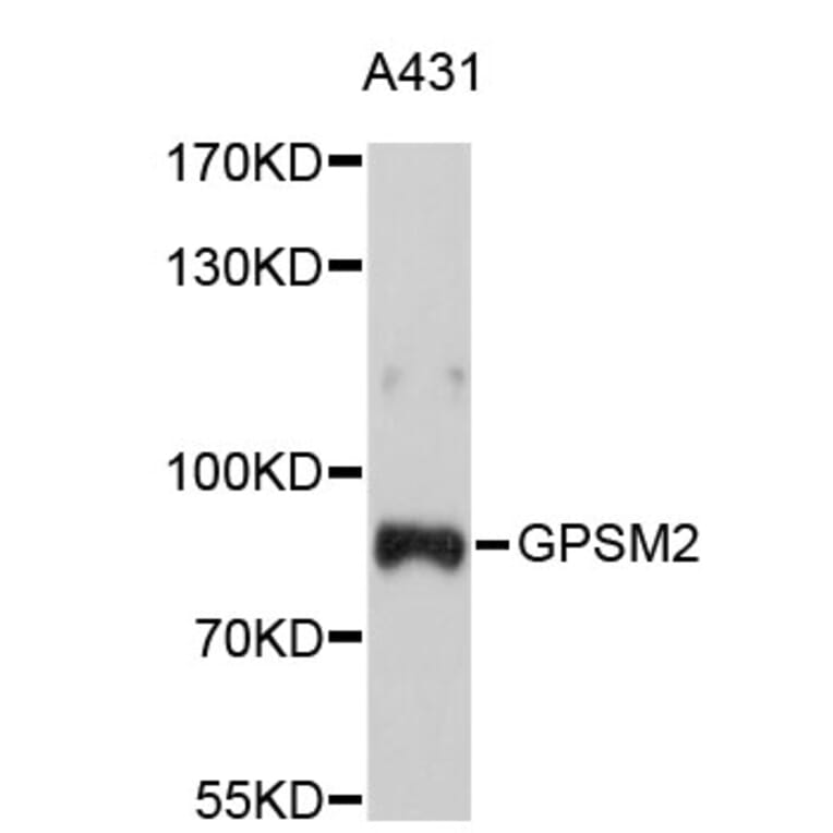 Western Blot - Anti-GPSM2 Antibody (A4677) - Antibodies.com
