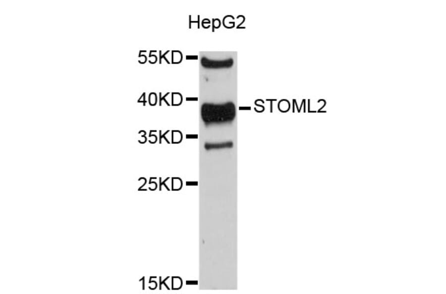 Western Blot - Anti-STOML2 Antibody (A4688) - Antibodies.com