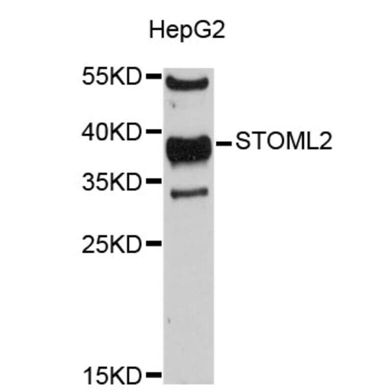 Western Blot - Anti-STOML2 Antibody (A4688) - Antibodies.com