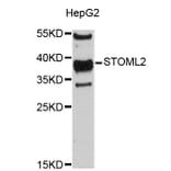 Western Blot - Anti-STOML2 Antibody (A4688) - Antibodies.com