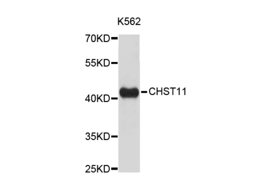 Western Blot - Anti-CHST11 Antibody (A4690) - Antibodies.com