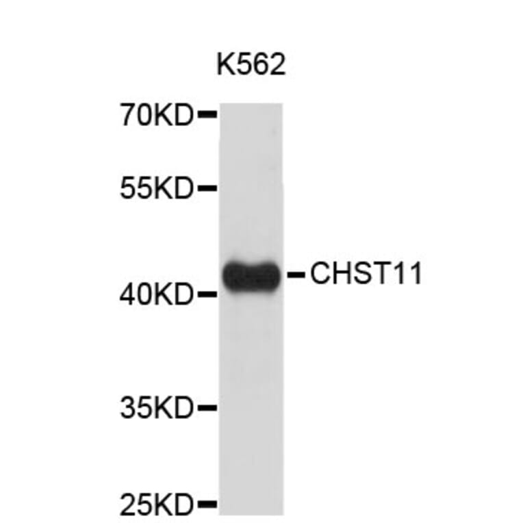 Western Blot - Anti-CHST11 Antibody (A4690) - Antibodies.com