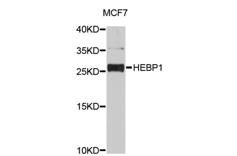 Western Blot - Anti-HEBP1 Antibody (A4697) - Antibodies.com