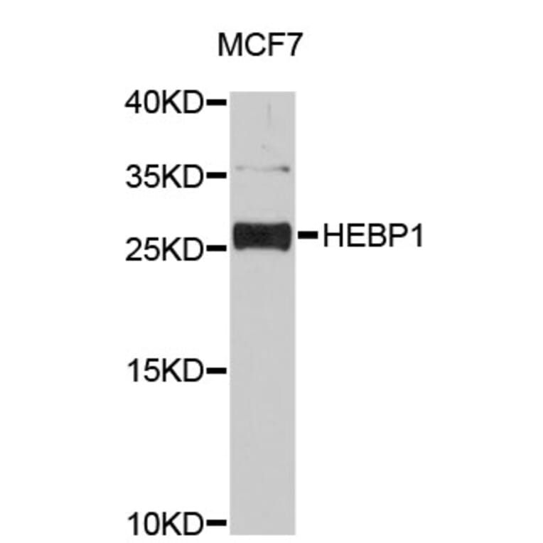 Western Blot - Anti-HEBP1 Antibody (A4697) - Antibodies.com