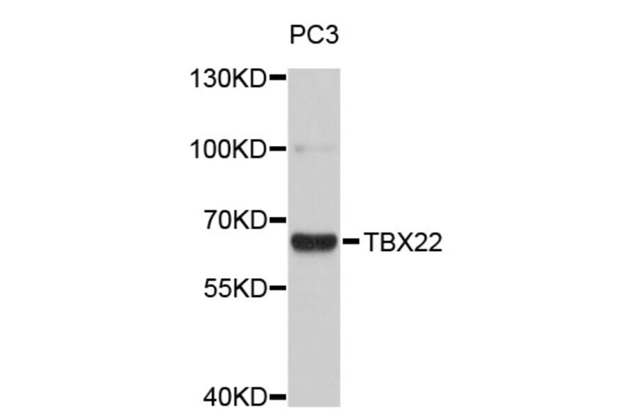 Western Blot - Anti-TBX22 Antibody (A4698) - Antibodies.com