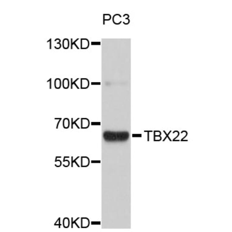 Western Blot - Anti-TBX22 Antibody (A4698) - Antibodies.com