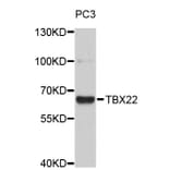 Western Blot - Anti-TBX22 Antibody (A4698) - Antibodies.com