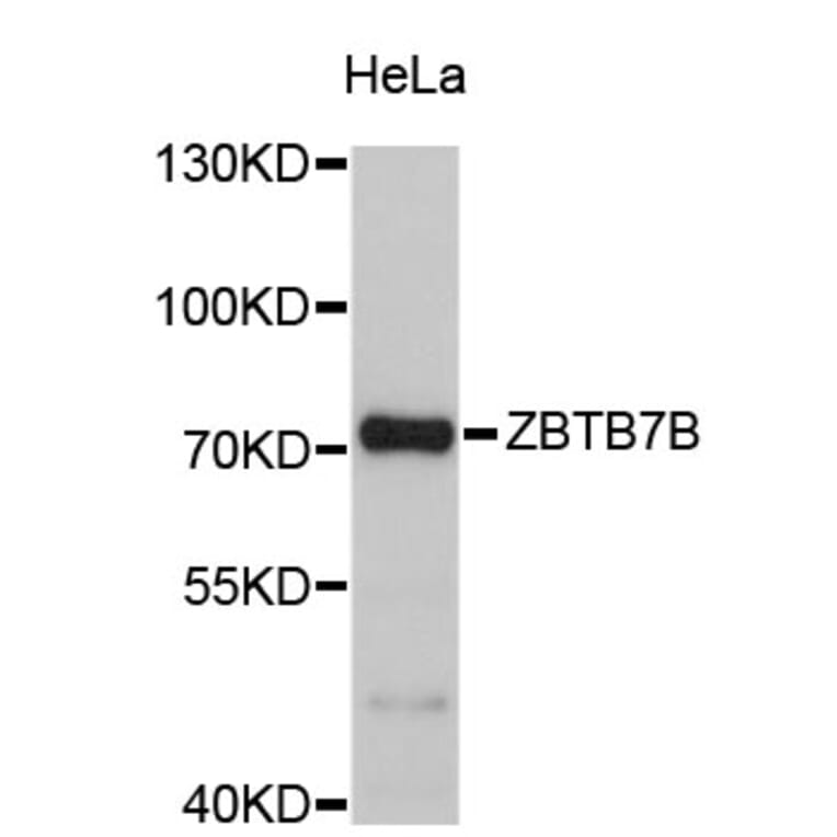 Western Blot - Anti-ZBTB7B Antibody (A4703) - Antibodies.com