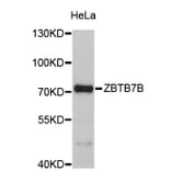 Western Blot - Anti-ZBTB7B Antibody (A4703) - Antibodies.com