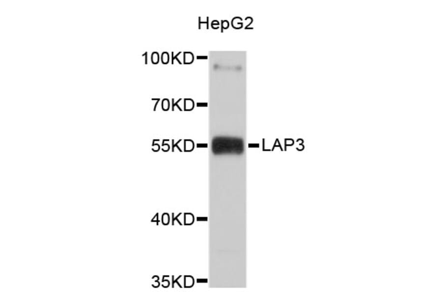 Western Blot - Anti-LAP3 Antibody (A4704) - Antibodies.com