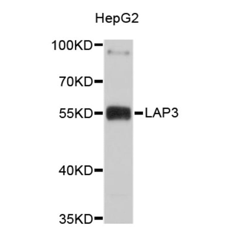 Western Blot - Anti-LAP3 Antibody (A4704) - Antibodies.com