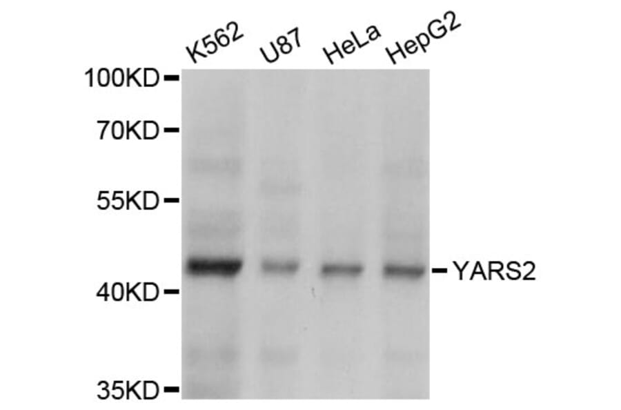 Western Blot - Anti-YARS2 Antibody (A4706) - Antibodies.com