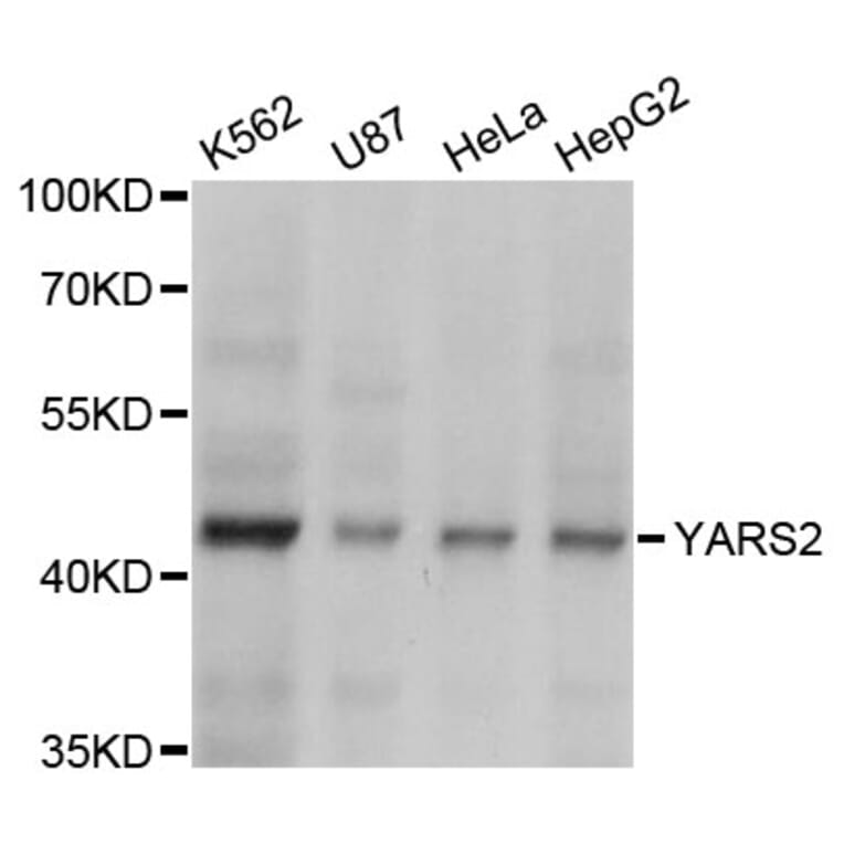 Western Blot - Anti-YARS2 Antibody (A4706) - Antibodies.com