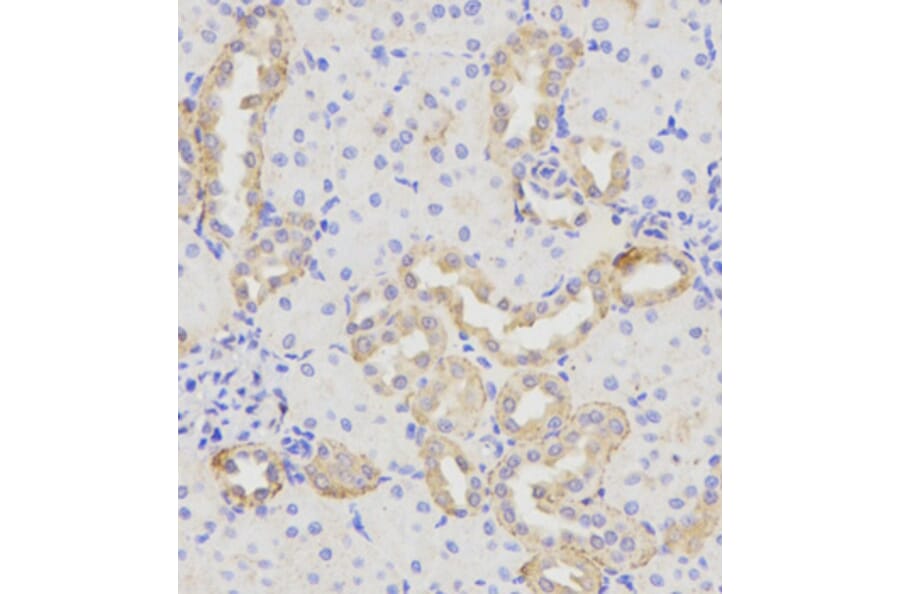 Immunohistochemistry - Anti-SH3GLB1 Antibody (A4709) - Antibodies.com