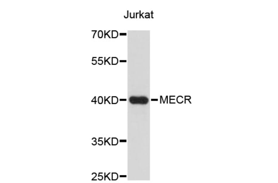Western Blot - Anti-MECR Antibody (A4710) - Antibodies.com