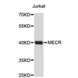 Western Blot - Anti-MECR Antibody (A4710) - Antibodies.com