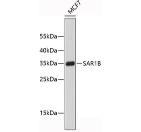 Western Blot - Anti-SAR1B Antibody (A9547) - Antibodies.com