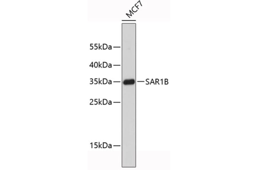 Western Blot - Anti-SAR1B Antibody (A9547) - Antibodies.com