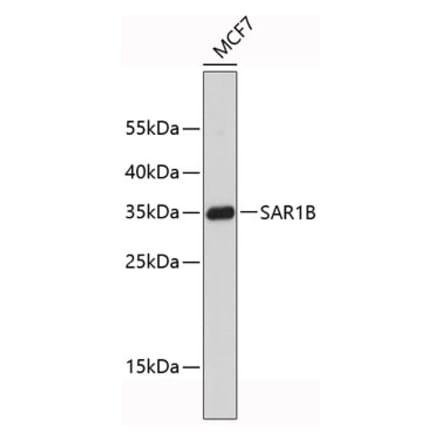 Western Blot - Anti-SAR1B Antibody (A9547) - Antibodies.com