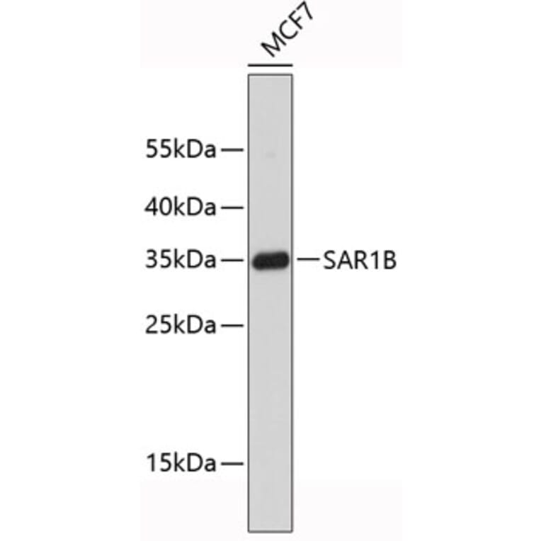 Western Blot - Anti-SAR1B Antibody (A9547) - Antibodies.com
