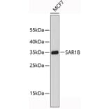 Western Blot - Anti-SAR1B Antibody (A9547) - Antibodies.com