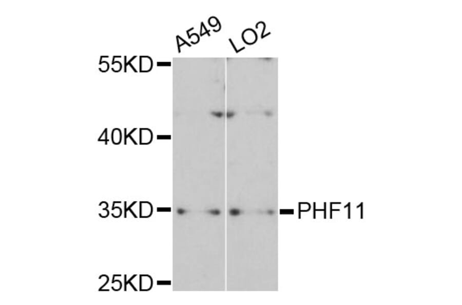 Western Blot - Anti-PHF11 Antibody (A4713) - Antibodies.com