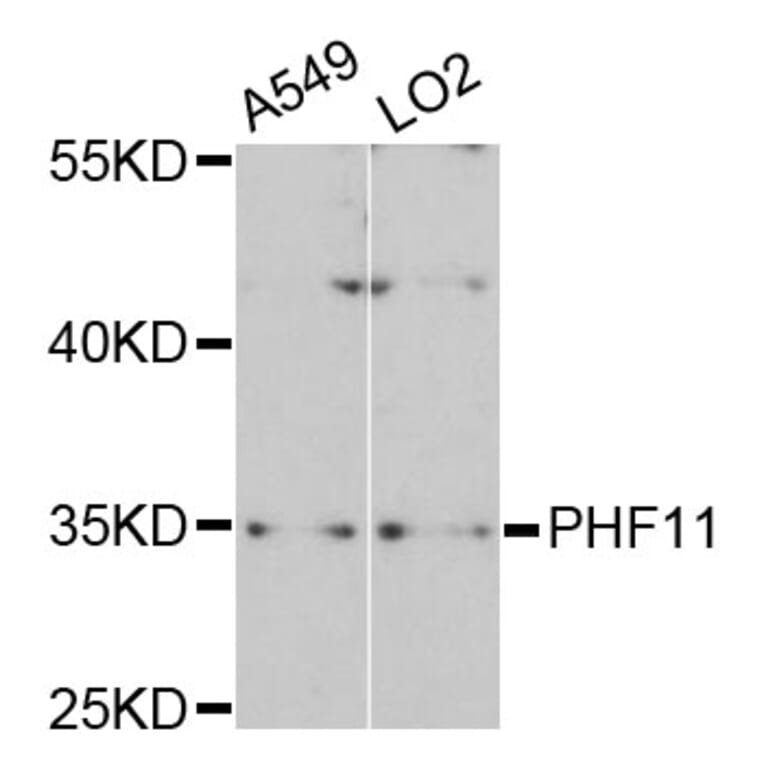 Western Blot - Anti-PHF11 Antibody (A4713) - Antibodies.com