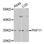 Western Blot - Anti-PHF11 Antibody (A4713) - Antibodies.com