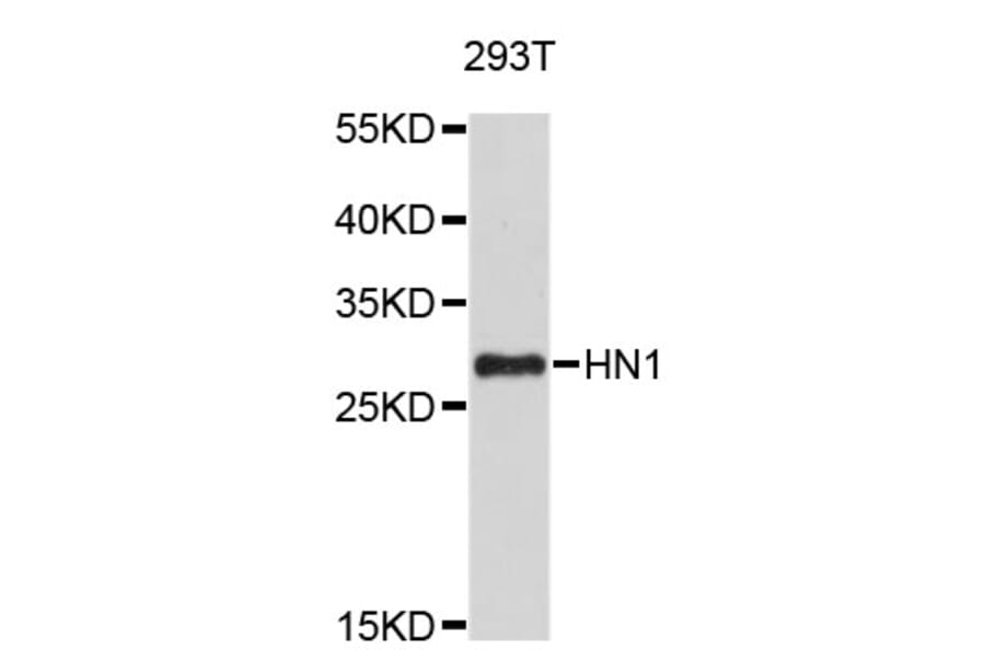 Western Blot - Anti-HN1 Antibody (A4716) - Antibodies.com