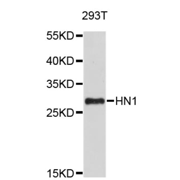 Western Blot - Anti-HN1 Antibody (A4716) - Antibodies.com
