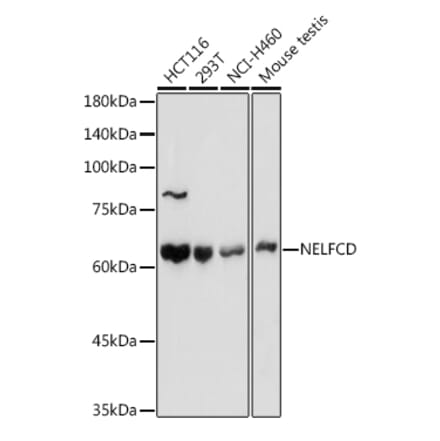 Western Blot - Anti-TH1L Antibody (A9551) - Antibodies.com