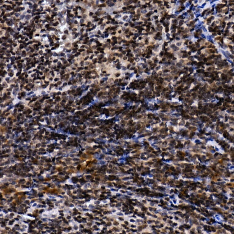 Immunohistochemistry - Anti-TH1L Antibody (A9551) - Antibodies.com