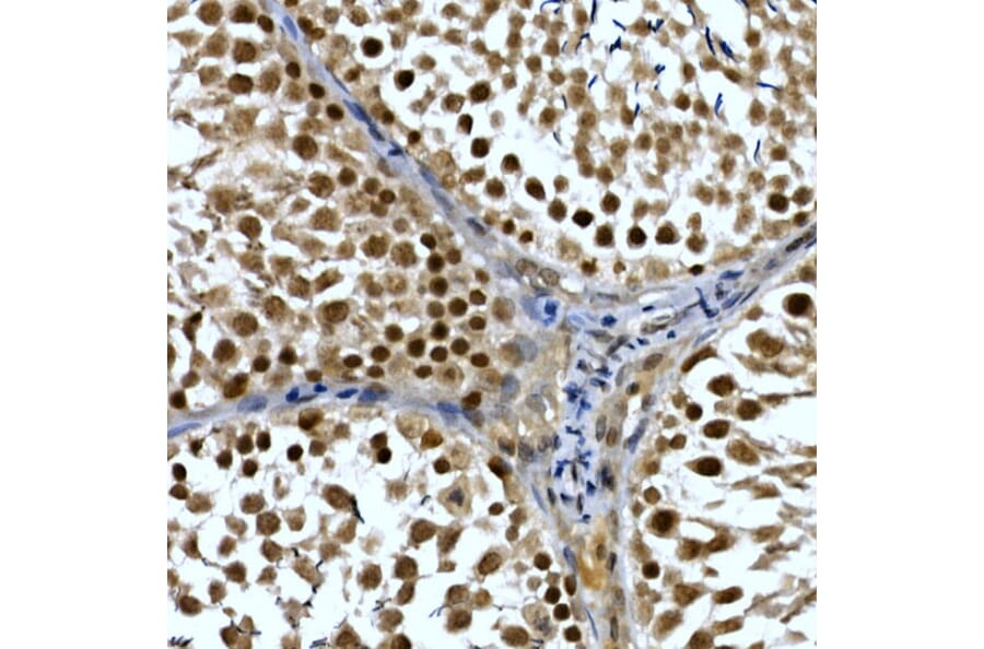 Immunohistochemistry - Anti-TH1L Antibody (A9551) - Antibodies.com