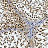 Immunohistochemistry - Anti-TH1L Antibody (A9551) - Antibodies.com