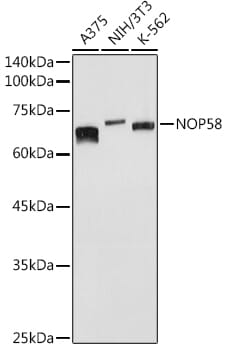 Western blot analysis of extracts of various cell lines, using Anti-NOP58 Antibody (A4749) at 1:1,000 dilution.
Secondary antibody: Goat Anti-Rabbit IgG (H+L) (HRP) (AS014) at 1:10,000 dilution.
Lysates / proteins: 25µg per lane.
Blocking buffer: 3% non-fat dry milk in TBST.
Detection: ECL Basic Kit (RM00020).
Exposure time: 5s.