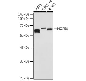 Western Blot - Anti-NOP58 Antibody (A9553) - Antibodies.com