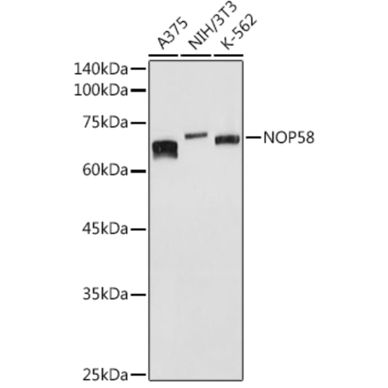 Western Blot - Anti-NOP58 Antibody (A9553) - Antibodies.com