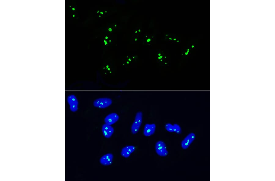 Immunofluorescence - Anti-NOP58 Antibody (A9553) - Antibodies.com