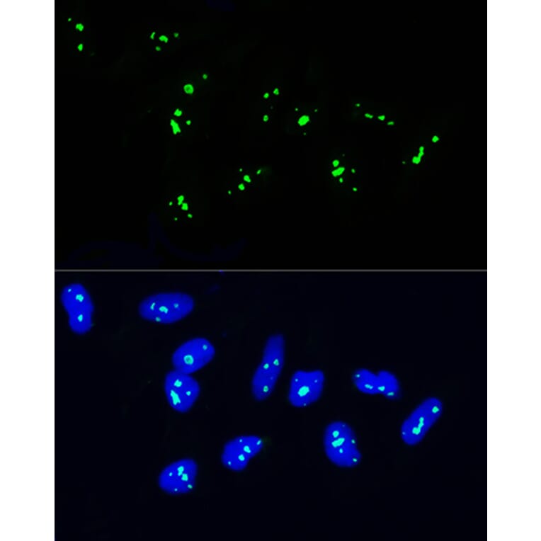 Immunofluorescence - Anti-NOP58 Antibody (A9553) - Antibodies.com