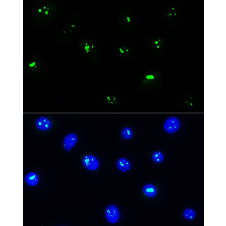Immunofluorescence - Anti-NOP58 Antibody (A9553) - Antibodies.com