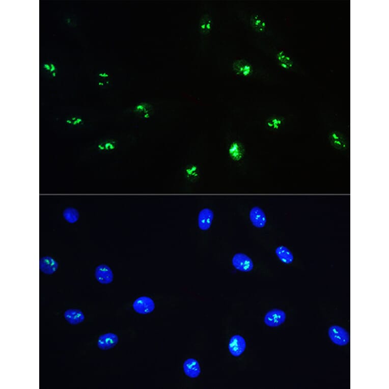 Immunofluorescence - Anti-NOP58 Antibody (A9553) - Antibodies.com