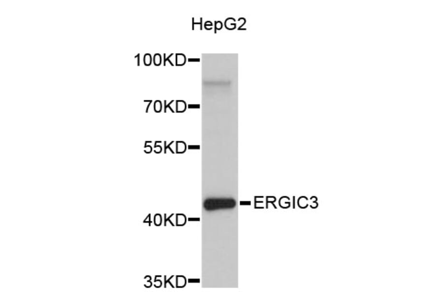 Western Blot - Anti-ERGIC3 Antibody (A4751) - Antibodies.com
