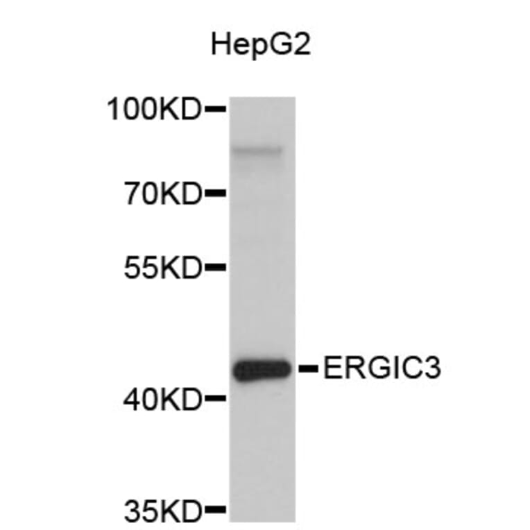 Western Blot - Anti-ERGIC3 Antibody (A4751) - Antibodies.com