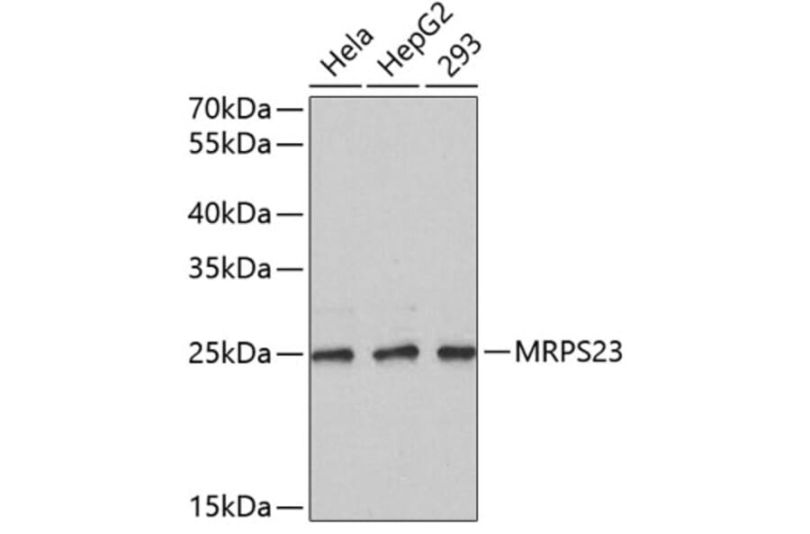 Western Blot - Anti-MRPS23 Antibody (A4754) - Antibodies.com