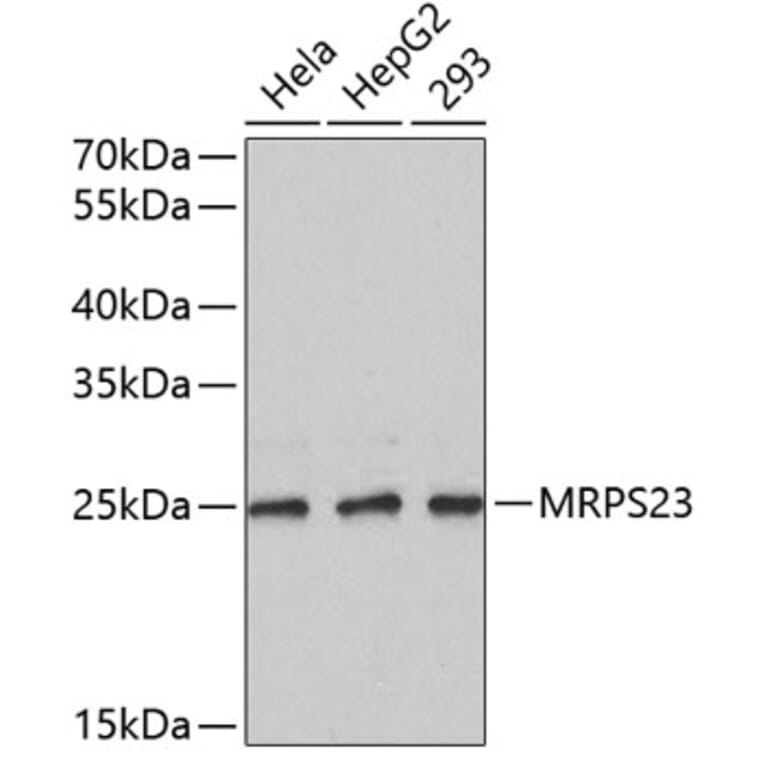 Western Blot - Anti-MRPS23 Antibody (A4754) - Antibodies.com