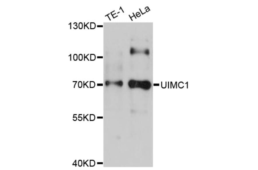 Western Blot - Anti-UIMC1 Antibody (A4759) - Antibodies.com