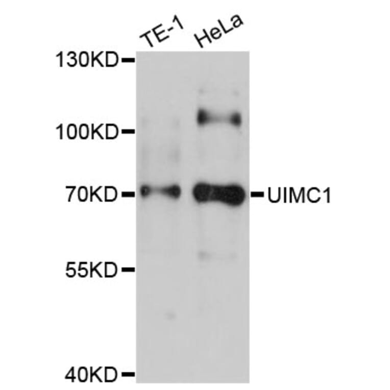 Western Blot - Anti-UIMC1 Antibody (A4759) - Antibodies.com