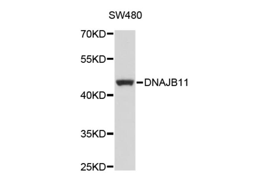 Western Blot - Anti-DNAJB11 Antibody (A4760) - Antibodies.com