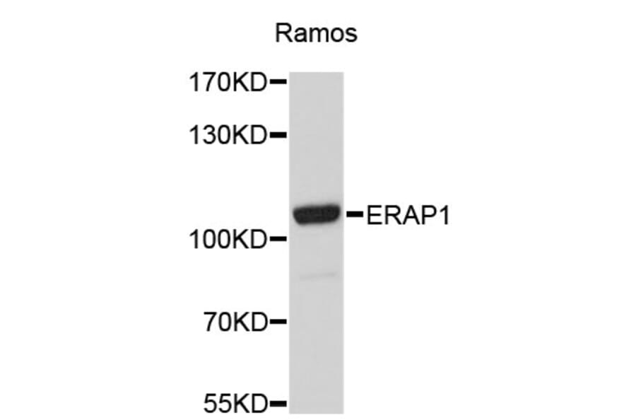 Western Blot - Anti-ERAP1 Antibody (A4762) - Antibodies.com